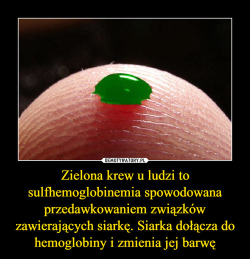 Zielona krew u ludzi to sulfhemoglobinemia spowodowana przedawkowaniem związków zawierających siarkę. Siarka dołącza do hemoglobiny i zmienia jej barwę