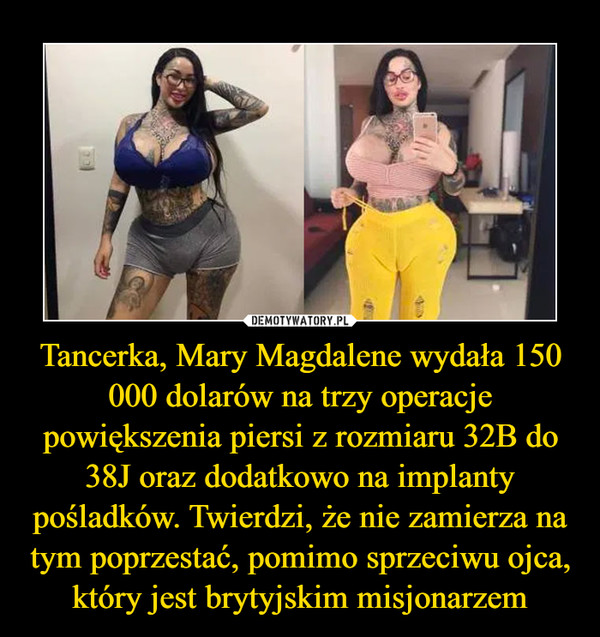 Tancerka, Mary Magdalene wydała 150 000 dolarów na trzy operacje powiększenia piersi z rozmiaru 32B do 38J oraz dodatkowo na implanty pośladków. Twierdzi, że nie zamierza na tym poprzestać, pomimo sprzeciwu ojca, który jest brytyjskim misjonarzem