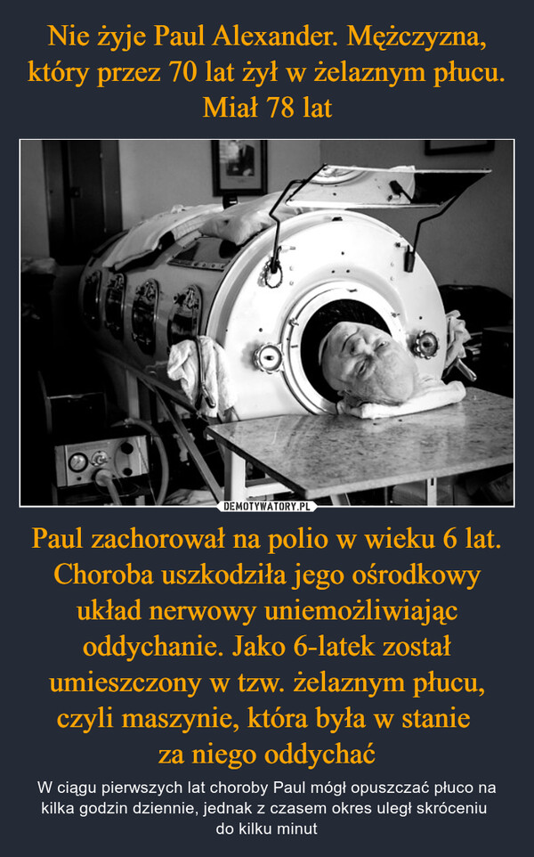 Paul zachorował na polio w wieku 6 lat. Choroba uszkodziła jego ośrodkowy układ nerwowy uniemożliwiając oddychanie. Jako 6-latek został umieszczony w tzw. żelaznym płucu, czyli maszynie, która była w stanie za niego oddychać – W ciągu pierwszych lat choroby Paul mógł opuszczać płuco na kilka godzin dziennie, jednak z czasem okres uległ skróceniu do kilku minut 